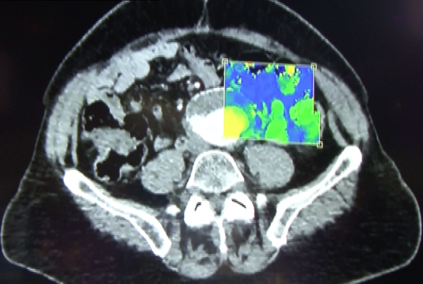 nuclear medicine diagnostic market, North America, PET, SPECT, Mordor