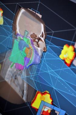 FDA Clears RayStation 3.5 Treatment Planning System