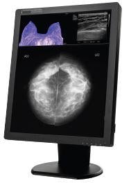 Richardson Healthcare, N-Series diagnostic displays, breast imaging, multimodality viewing, SIIM 2016