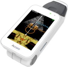 Accuro, handheld ultrasound, Rivanna Medical, spinal anesthesia guidance, FDA