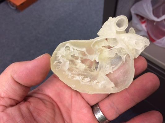 Stratasys, 3DHEART trial, open enrollment, 3-D printed pediatric heart models