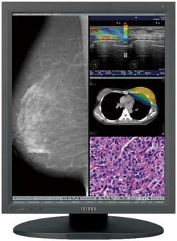 Quest International, Totoku CCL550i2 diagnostic display, FFDM approval, full-field digital mammography, breast imaging applications