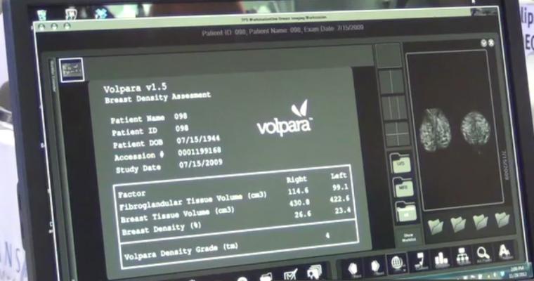 Volpara, VolparaDensity, version 3.0, RSNA 2014