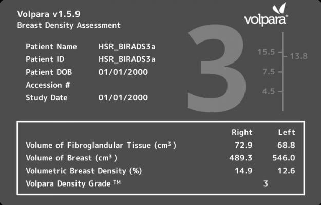 fibroglandular breast density, breast cancer screening performance, Breast Cancer Research and Treatment study, Volpara Density