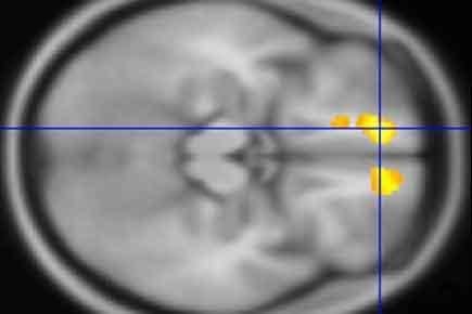 Tourette's, MRI brain scans, children, Washington University of St. Louis School of Medicine