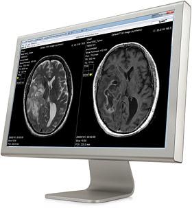 SyMRI, Cincinnati, CCHMC, synthetic MRI, pediatrics 