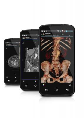 ResolutionMD, CFDA approval, mobile diagnostic images, 