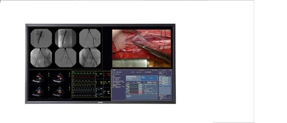 Barco, MultiSense Develop Telemedicine System for Heart Surgery Master Class