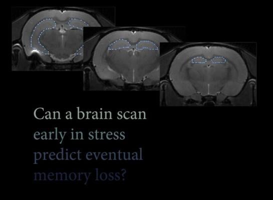 neuo imaging, MRI