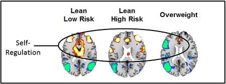 fMRI Study Suggets Childhood Obesity Could Be a Psychological Disorder
