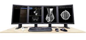 pacs RIS mammography reporting software RSNA women intelerad inteleris