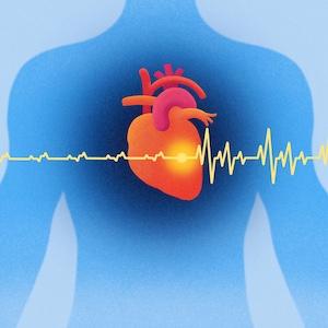 MRI, cardiac imaging, AI