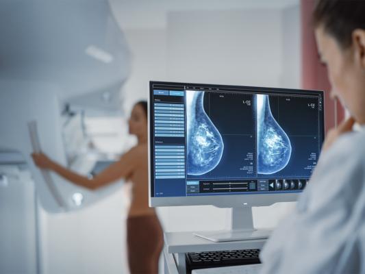 ProFound Cloud, powered by Google Cloud architecture and Google’s Health AI innovations, redefines accessibility to critical insights, empowering radiologists in early breast cancer detection