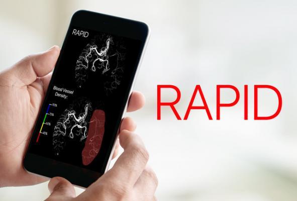 iSchemaView Brings RAPID Imaging Platform to Australia and New Zealand