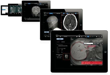 remote viewing systems software mobile devices rsna 2013 aycan