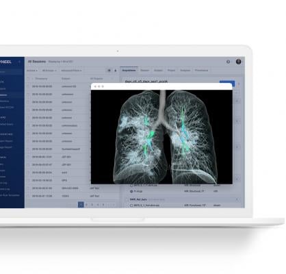 Flywheel Exchange, Inc., a leading bioinformatics platform for cloud-scale data management and collaboration, and Imbio, a leading provider of artificial intelligence (AI) solutions for medical imaging analysis, have partnered to accelerate lung disease discovery, diagnosis, and treatment in the Life Sciences.