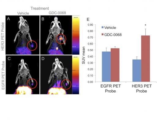 PET probes, breast cancer, surface receptor changes, MGH study, Memorial Sloan Kettering