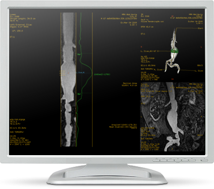 CardiacVX MR VesselIQ Xpress GE Healthcare MR Systems Advanced Visualization
