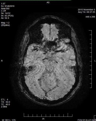 fMRI, brain circuits, stress response, Yale study, PNAS