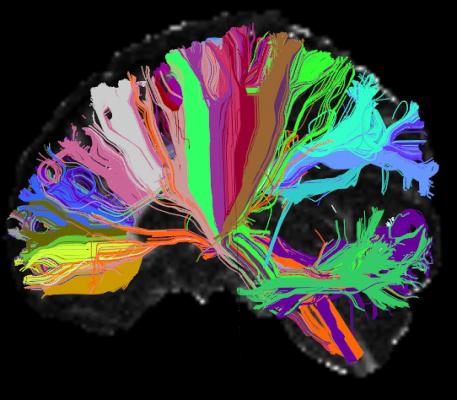 NIH, Human Connectome Project, HCP, brain MRI, predict behavior