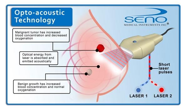 Seno Medical Instruments, Imagio breast imaging system, PIONEER Study, optoacoustics