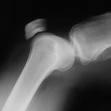 Orthopedics Gets a Leg Up on Image-Enabled EHR