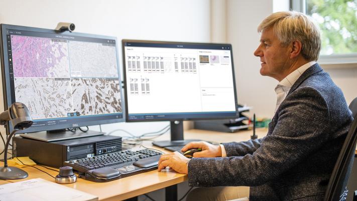 Latest iteration of Philips IntelliSite Pathology Solution helps support pathologists to work more efficiently in an automated digital workflow