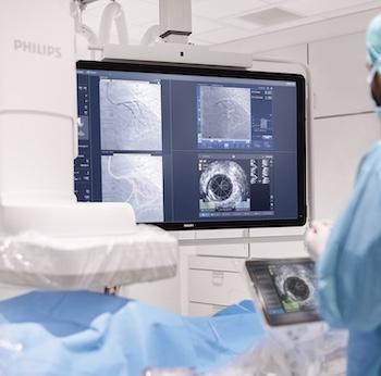 Philips Enters Agreement to Acquire SpectraWAVE