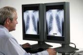 FDA Approves Improved Chest X-ray Technology  