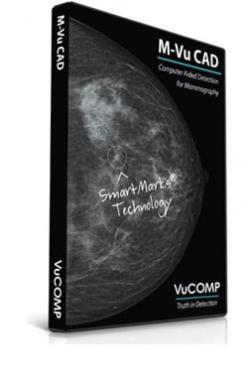 mammography systems rsna computer aided detection women's health vucomp konica