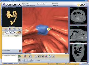 icad veralook colonoscopy ct systems software mri computer aided RSNA 2013
