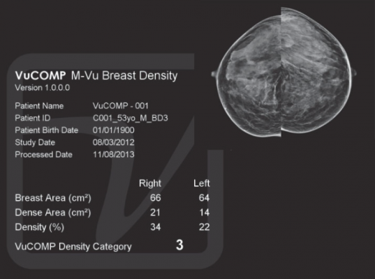 mammography systems women's healthcare vucomp m-vu breast density