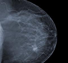 Breast Density and Mammography Reporting Act Kuster Women's Health