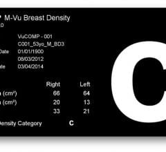 VuComp M-Vu Breast Density Mammography Reporting Software Women's Health