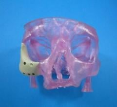 3-D Printed OsteoFab Patient-Specific Facial Device