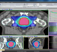 high-risk prostate cancer, radical local treatment, Umea University Sweden study, mortality