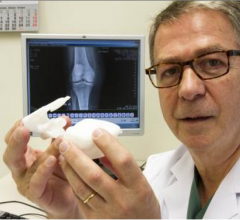First Patient Successfully Treated with X-Ray Based Knee Guide Technology