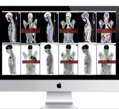 Aycan Chimaera FusionSync Advanced Visualization Fusion Imaging Software