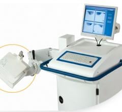 New Technologies Open the Door for Low Dose Breast-Specific Gamma Imaging/Molecular Imaging 