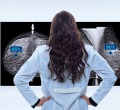 Leader in Women’s Health Will Highlight New Imaging Solutions That Aid in Cancer Detection and Radiologist Workflow 