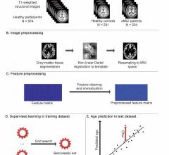 Researchers have developed an artificial intelligence (AI)-based brain age prediction model to quantify deviations from a healthy brain-aging trajectory in patients with mild cognitive impairment, according to a study published in Radiology: Artificial Intelligence. The model has the potential to aid in early detection of cognitive impairment at an individual level.