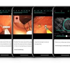 American Society for Gastrointestinal Endoscopy and Touch Surgery Pilot Video-Based Endoscopic Simulations