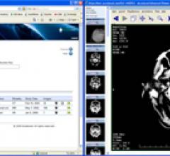 Cloud Computing Supports Orthopedic Image Exchange