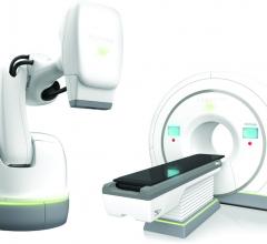 First Hospitals Achieve Inter-System Connectivity Across Accuray Radiation Therapy Platforms