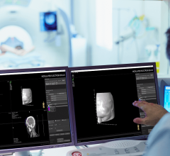 Adaptiiv is pioneering new approaches to bring personalization at scale to patients all over the world and is collaborating with HP and Varian to advance these efforts and meet evolving customer needs