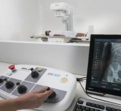 Agfa Brings Intelligent Radiography to RSNA 2018