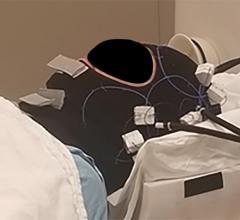 In this prototype design, no elements are placed over patient's eyes, nose, or mouth, which may improve comfort compared with conventional coils. In this image, identifiable portions of participant's face have been obscured for publication and privacy purposes. Image courtesy of the American Roentgen Ray Society (ARRS), American Journal of Roentgenology (AJR)