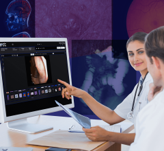 The Apollo Repository for Clinical Content, arcc v10.6, enables true Enterprise Imaging by securely managing all clinical images in a central repository 