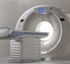 New York Hospital Finds Significant Cost Savings With Toshiba’s Aquilion One CT