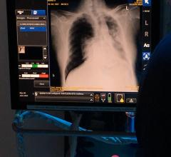 European Society of Radiology and GE Partner on Artificial Intelligence for ECR 2019